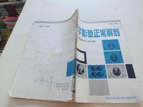 醫(yī)學(xué)影像正常解剖 X線解剖圖譜正常變異續(xù)編