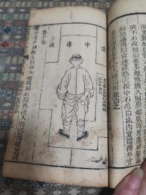 清 中医木刻本《医宗金鉴》存卷84～85 外科心法要诀 一册   内有精美版画48图  较之此书清晚版本的粗糙木刻图  有明显区别