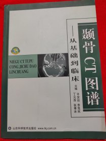 颞骨CT图谱：从基础到临床