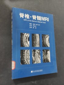 脊椎·脊髓MRI