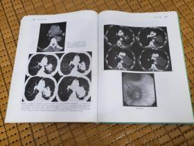 胸部CT和MRI（第4版）