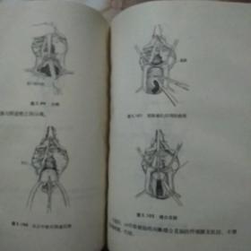 妇产科手术图解精装