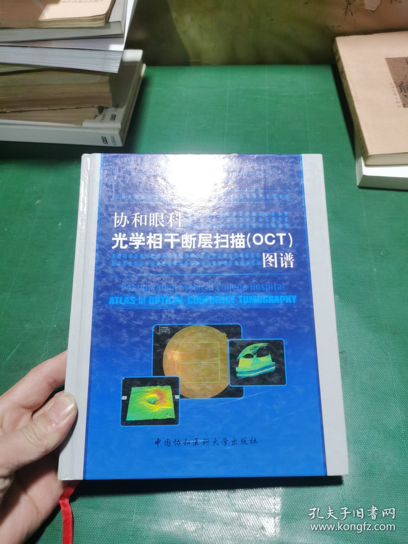 协和眼科光学相干断层扫描（OCT）图谱