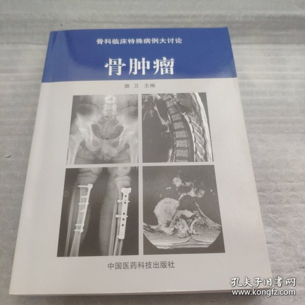 骨肿瘤