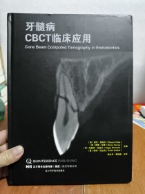 牙髓病CBCT临床应用(全新未开封)