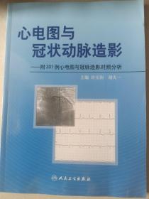 心电图与冠状动脉造影：附201例心电图与冠脉造影对照分析