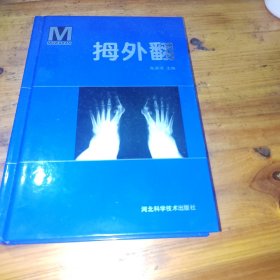 拇外翻