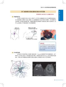 全新正版 肝胆胰外科手术实录 唐伟 9787117288170 人民卫生出版社