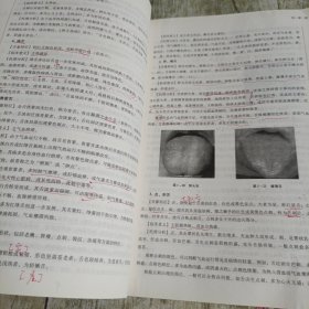 中医诊断学