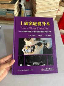 上颌窦底提升术