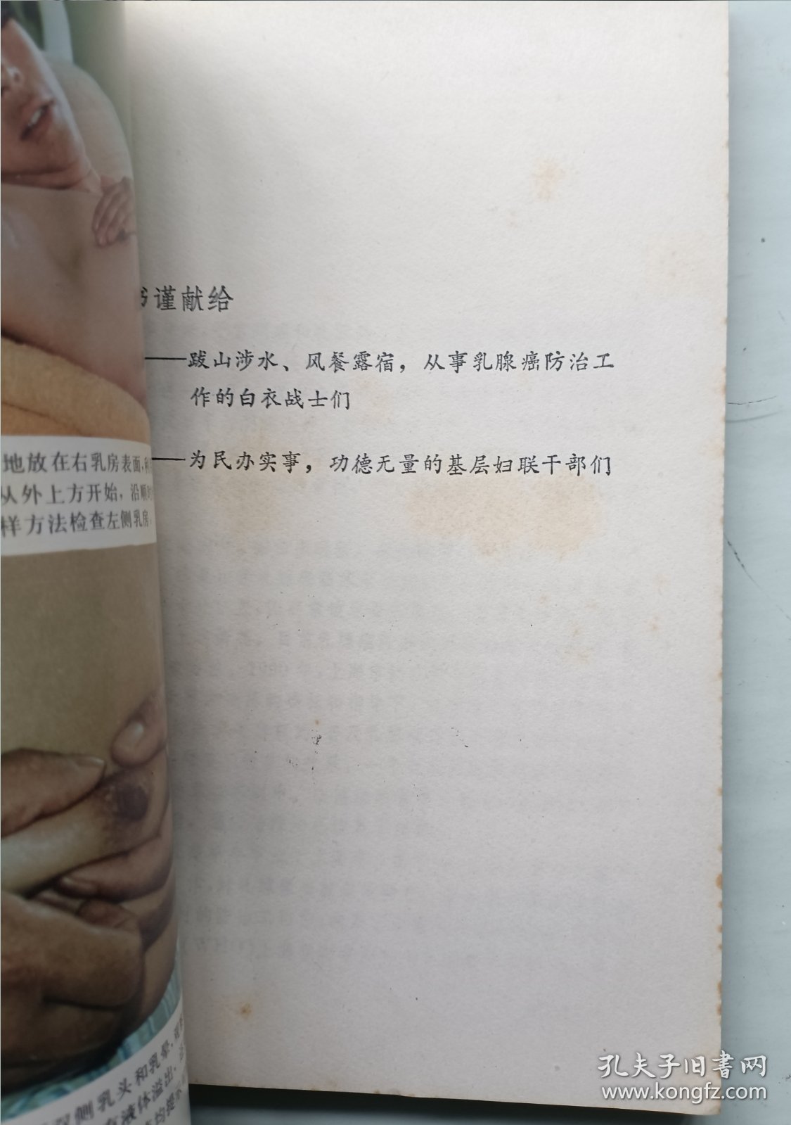 乳腺癌防治与自我检查