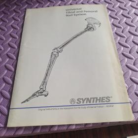 universal Tibial and Femoral Nail system 通用胫骨和股骨钉系统