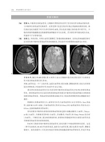 神经影像学：核心复习