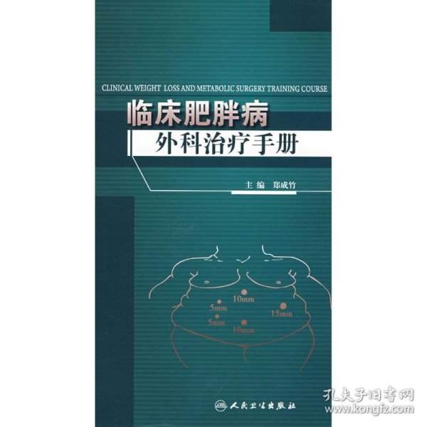 临床肥胖病外科治疗手册