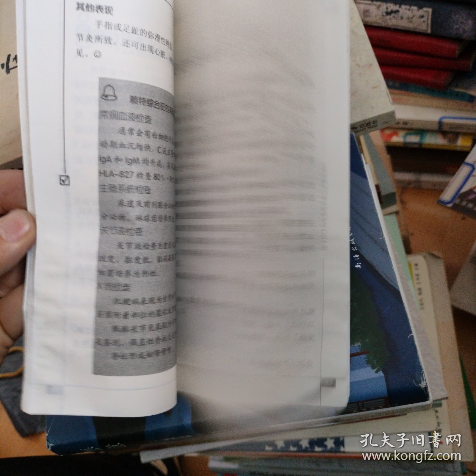 红斑狼疮与自身免疫病患者自助手册