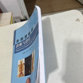 骨转移癌的诊断与治疗