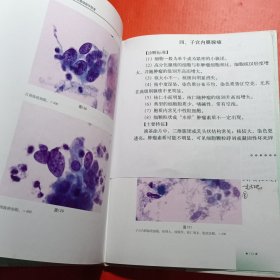 宫颈、阴道液基细胞学图谱