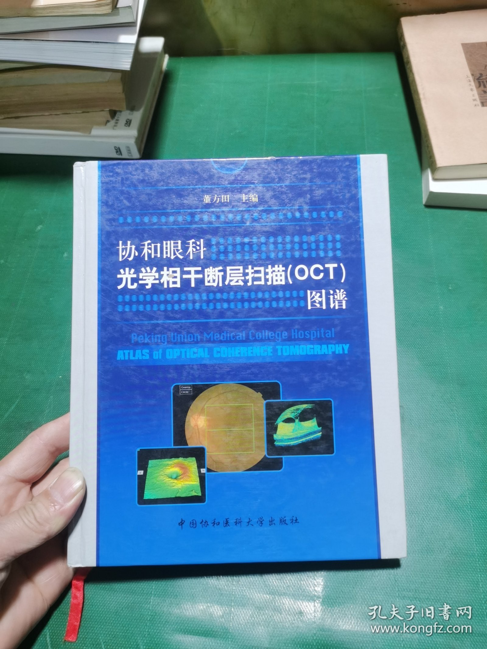协和眼科光学相干断层扫描（OCT）图谱