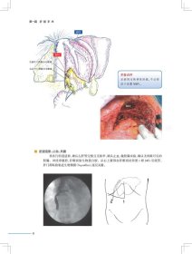 肝胆胰外科手术实录 9787117288170 唐伟 人民卫生出版社