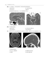 神经影像学：核心复习