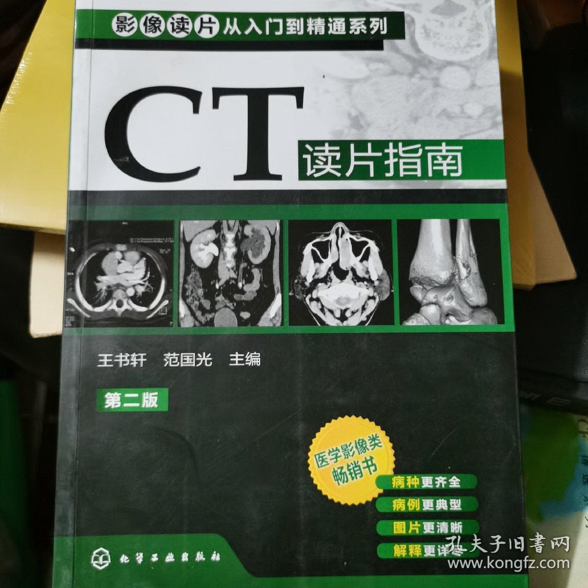 影像读片从入门到精通系列：CT读片指南（第2版）