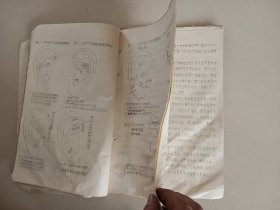 1976年油印耳穴诊疗法 20页左右