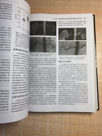 高血压与心血管疾病现代治疗学