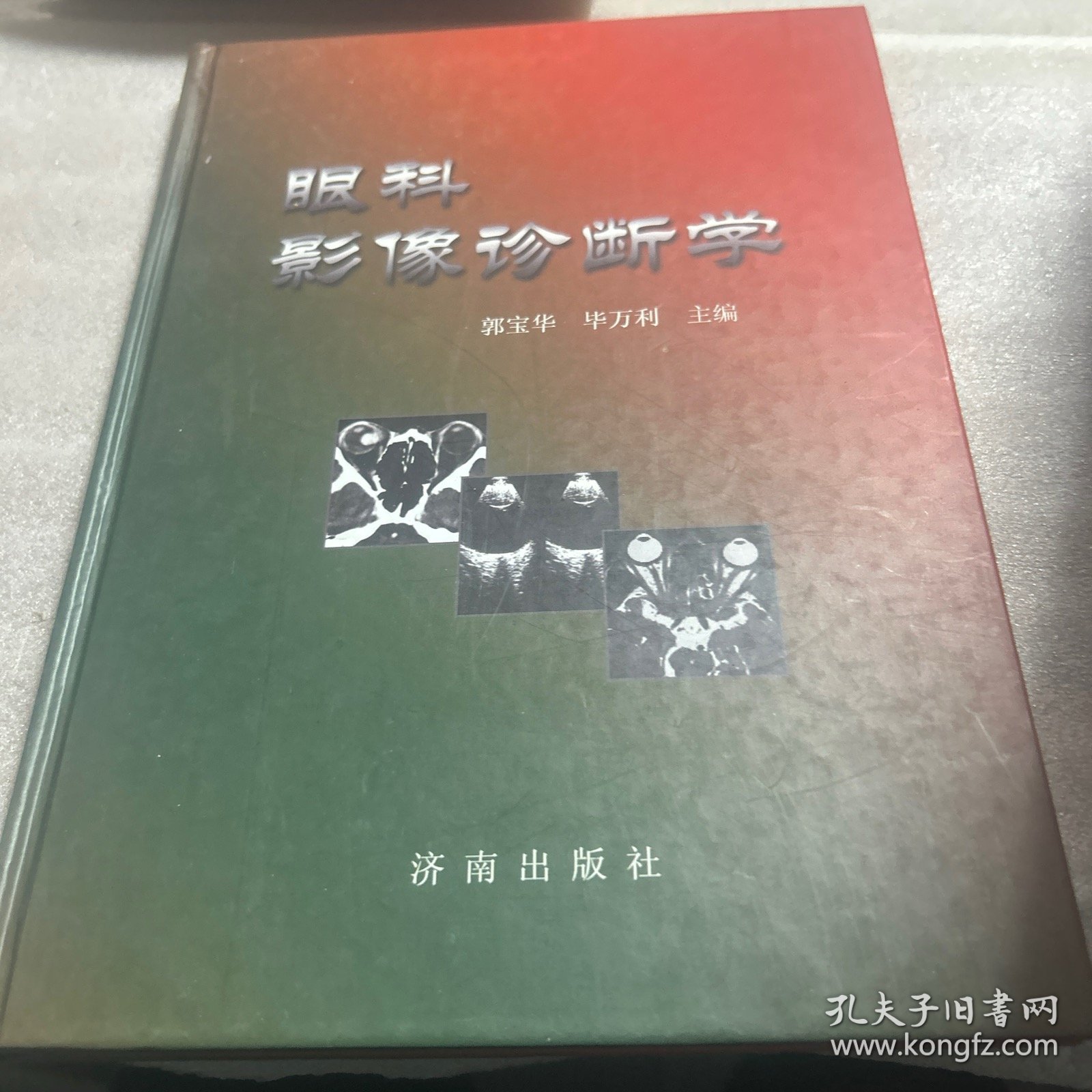 眼科影像诊断学