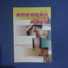 常见皮肤病问答与典型图例