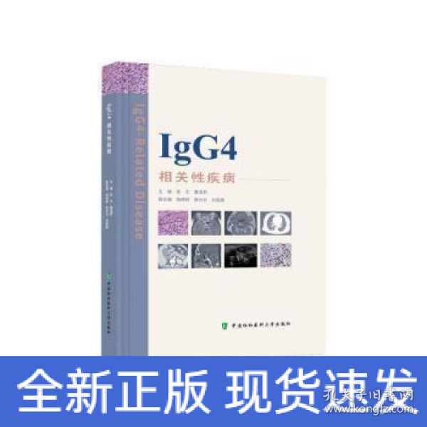 IgG4相关性疾病