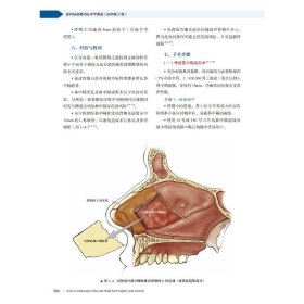 鼻内镜鼻窦颅底手术图谱 原书第2版