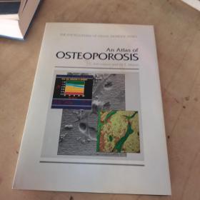 An Atlas of Osteoporosis (The Encyclopedia of Visual Medicin（骨质疏松症）