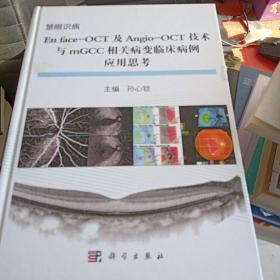 En face-OCT及Angio-OCT技术与mGCC相关病变临床病变应用思考(书皮有破损不影响阅读)