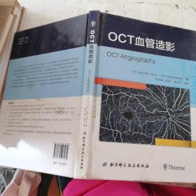 OCT血管造影