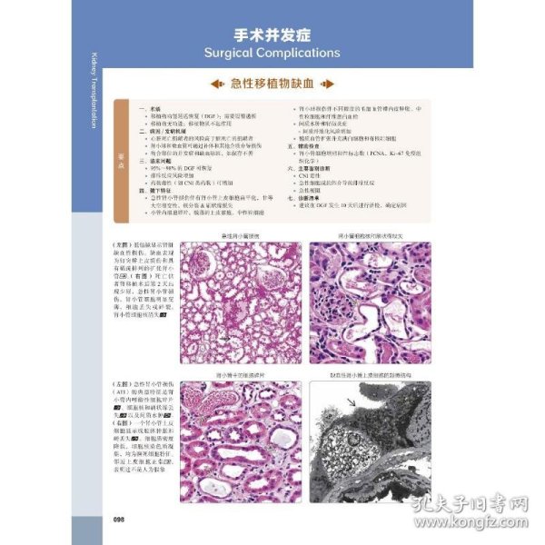 正版书移植诊断病理学原书第2版
