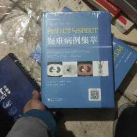 PET/CT与SPECT疑难病例集萃  临床精析病例集锦