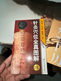 针灸穴位全真图解