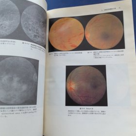 日文原版 ：《黄斑部疾患图解》正版馆藏太钢医院藏书，昭和52年（1977年）（实物拍图，外品内页如图，内页干净整洁无字迹，无划线）