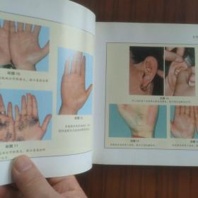 女性掌纹诊病技巧