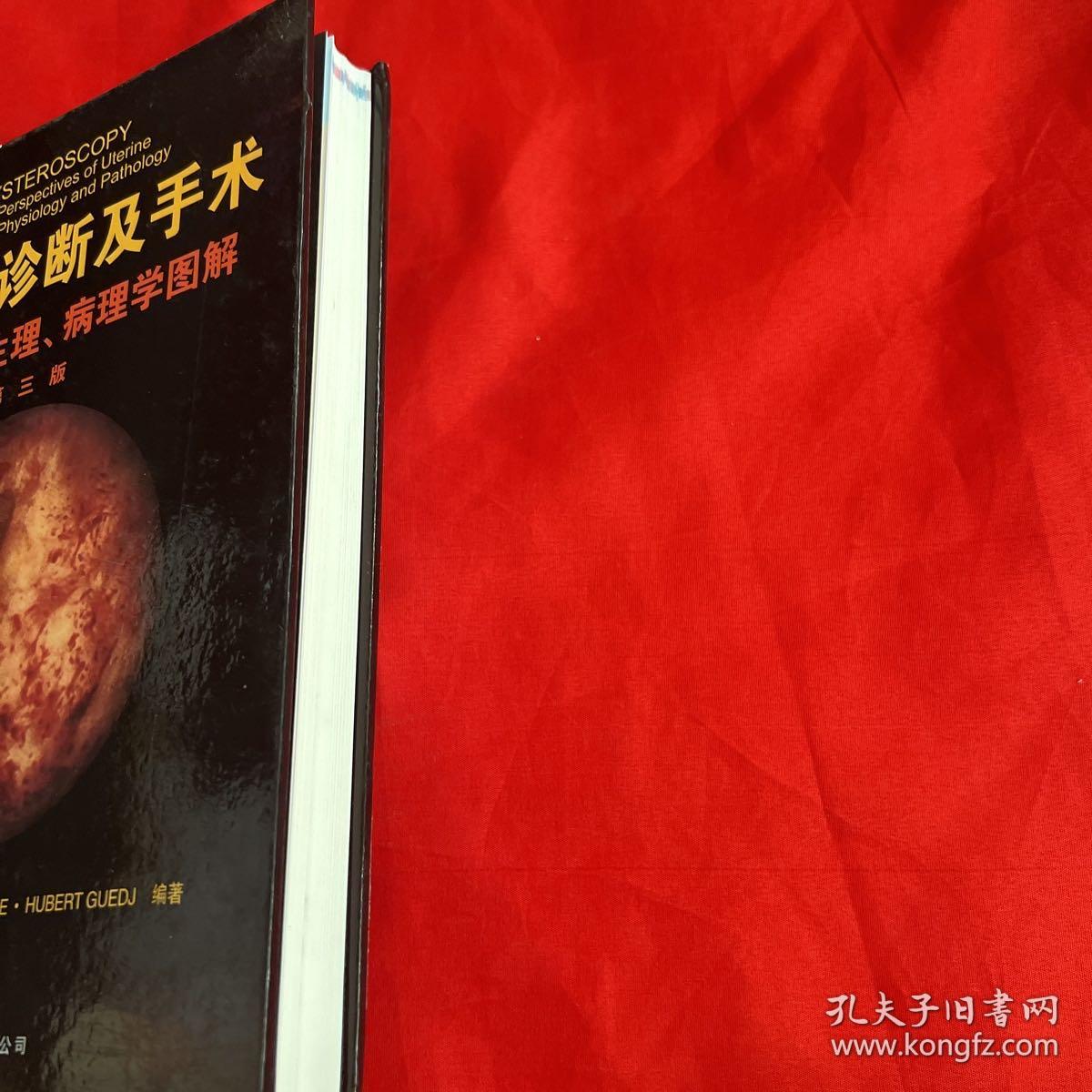 宫腔镜诊断及手术：解剖、生理、病理学图解
