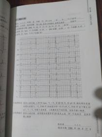 心电图报告书写规范