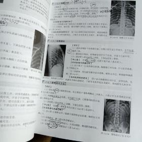 医学影像检查技术学