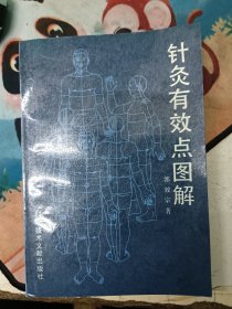 针灸有效点图解（有划线）