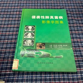 侵袭性肺真菌病影像学图集