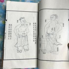 重订外科正宗 外径27x16.7cm 内府 桃花纸开化纸内径19.5x13.5cm12卷本之 初版本 品佳 存3-4卷 9-10卷 11-12卷三册