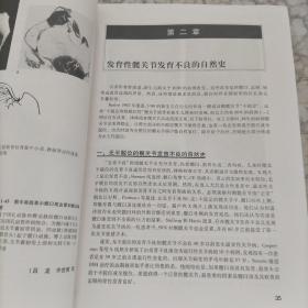 发育性髋关节发育不良  内容全新