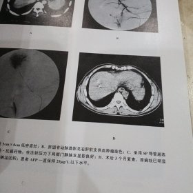 临床介入诊疗学