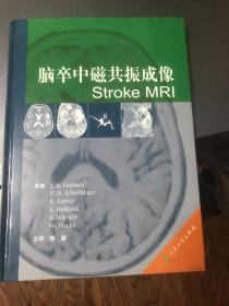 脑卒中磁共振成像Stroke MRI