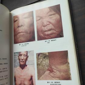 皮肤病临床与病理图谱