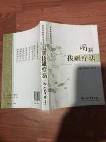 图解抜罐疗法